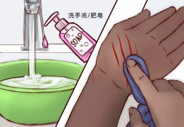 艾什卡普-用心愛你，始終陪伴